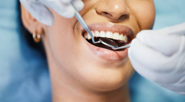 Best Emergency Tooth Extraction in Hebron, NE