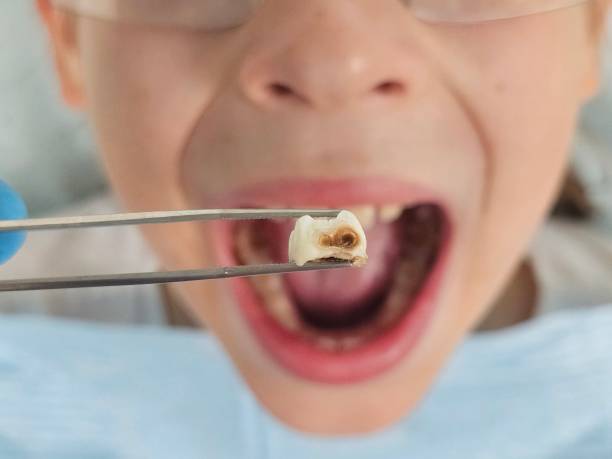 Best Cosmetic Emergency Dentistry in Hebron, NE
